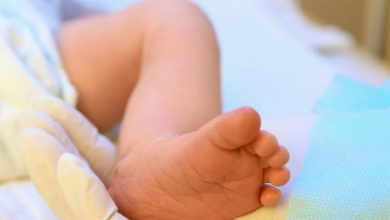 Bebeklerde Sarılık Nedenleri ve Tedavi Yöntemleri Nelerdir