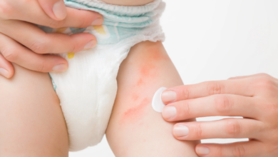 Bebeklerde Bez Alerjisi Nedir ve Neden Olur