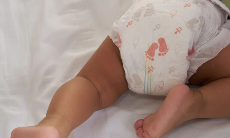 Bebek Bezi Egzaması Nedir, Belirtileri Nelerdir